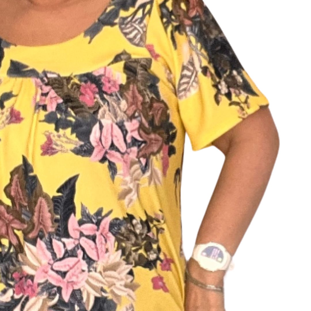 YELLOW TROPICAL SHORT SLEEVE SMOCK TOP